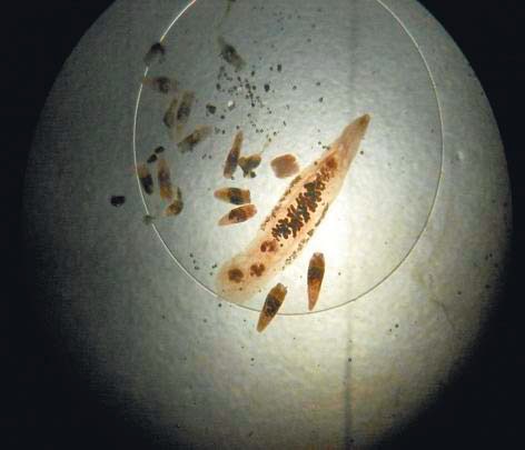 Рис. 4. Opisthorchis felineus и Pseudamphistomum truncatum (увеличение ×20)